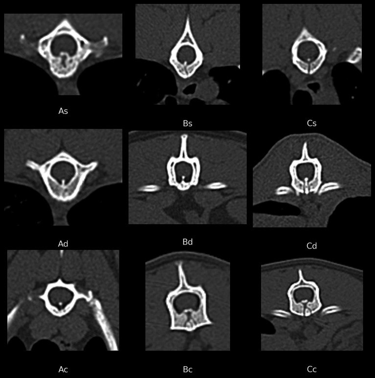 CT bone window