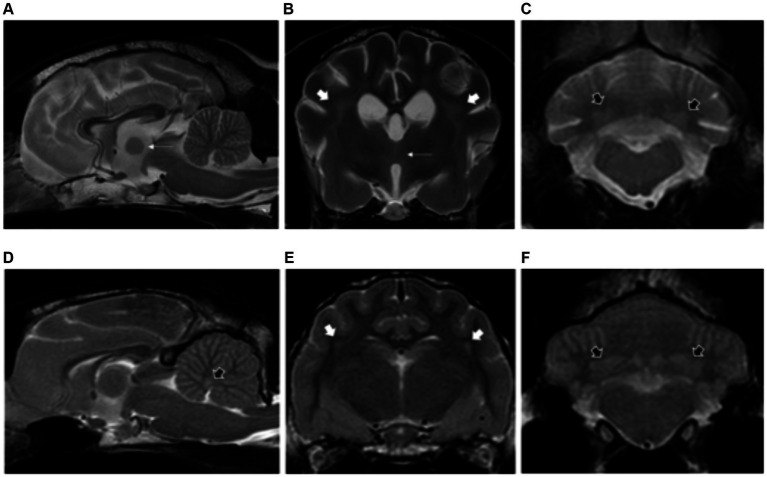 MRI brain T2